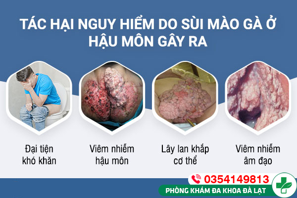 Hình ảnh minh họa